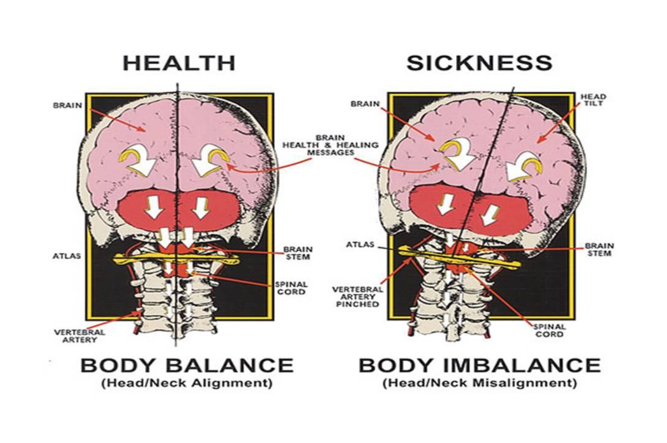 Atlas Orthogonal - Upper Cervical Adjustments